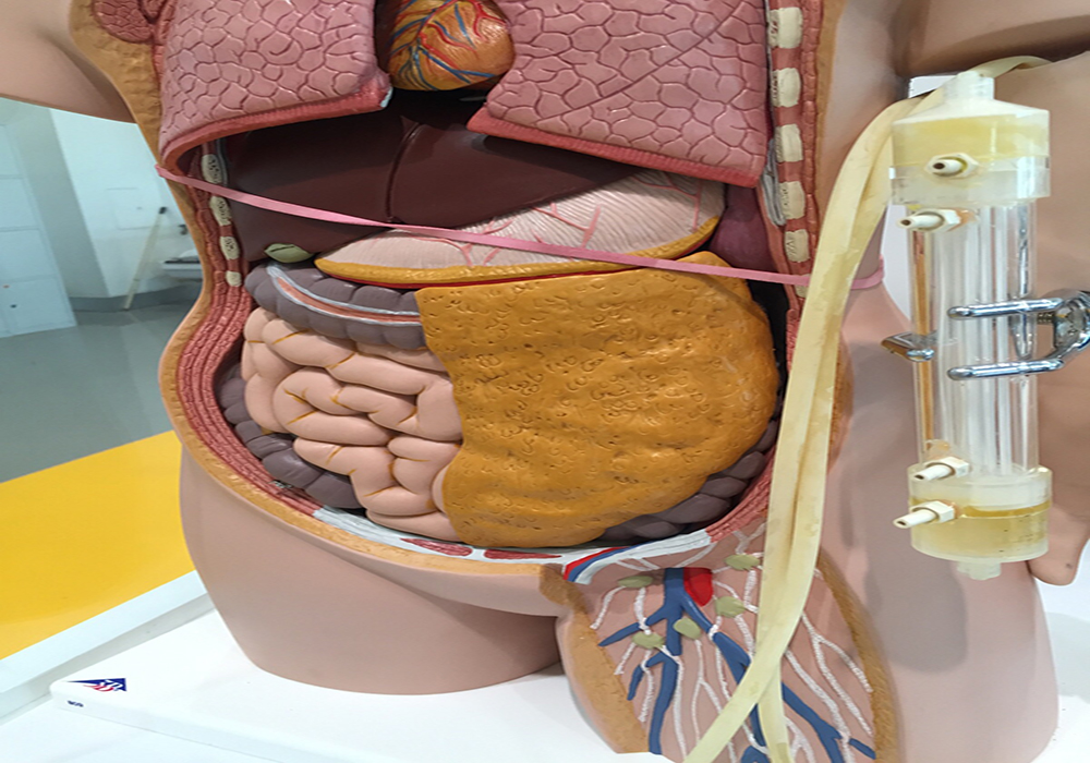 Bioartificial liver devices Bioartificial liver devices